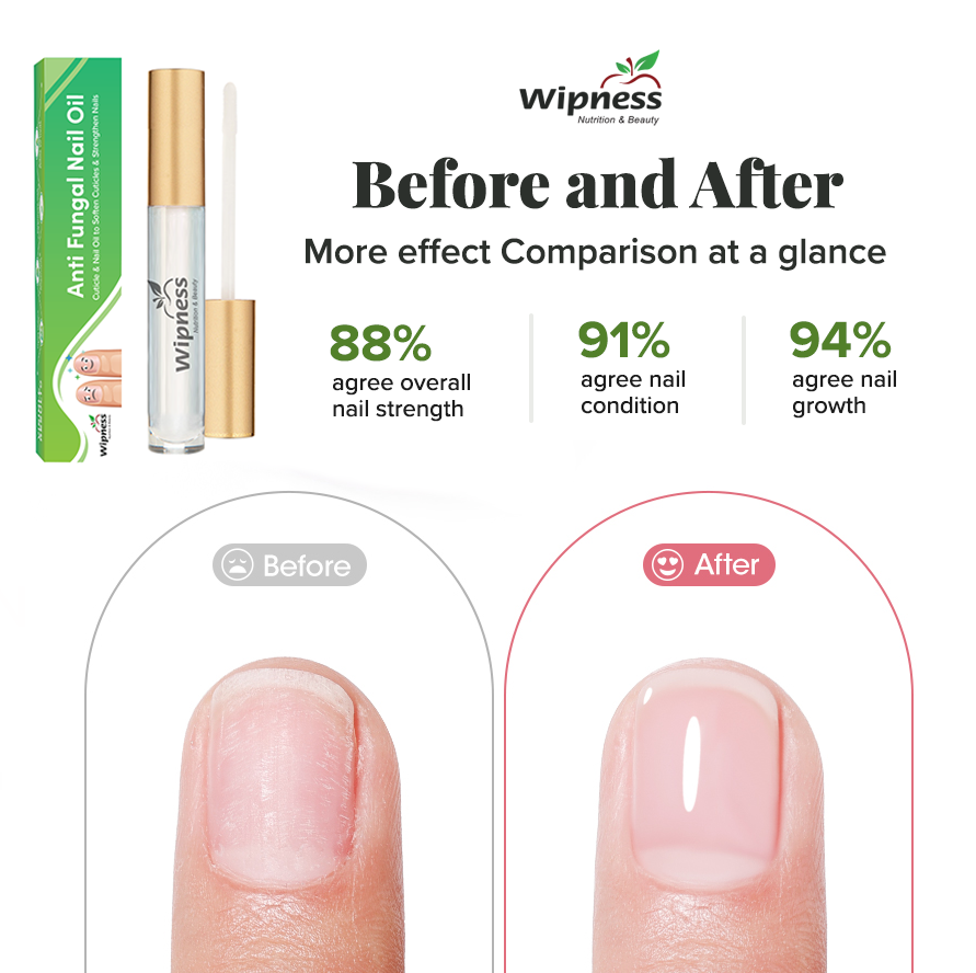 100% Natural Nail Repair Serum – Aloe Vera, Vitamin E & Neem Extract - Pack of 1 - 5 Ml