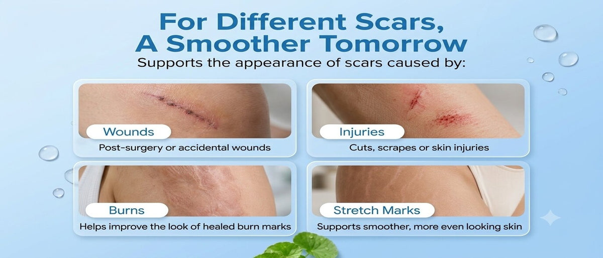 Silicone Scar Remover Gel Cream
