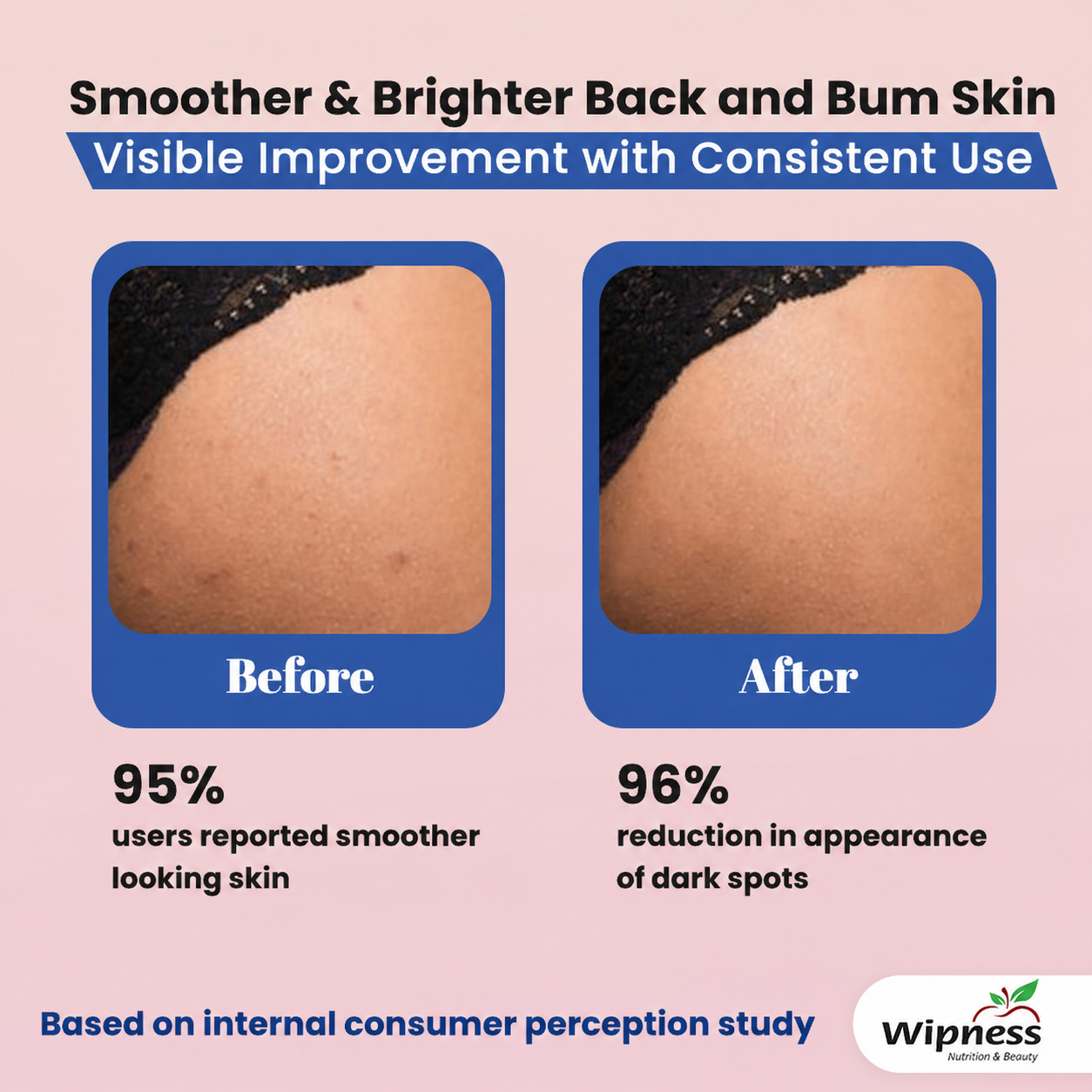 100% Natural Back & Bum Lightening Cream for Men & Women - 50GM