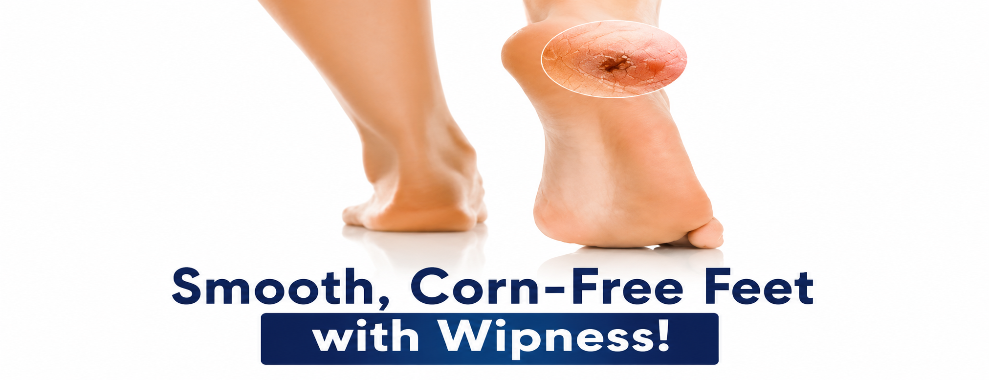 Wipness Corn Natural Removal Plaster – Pack of 1 - 20 Strips