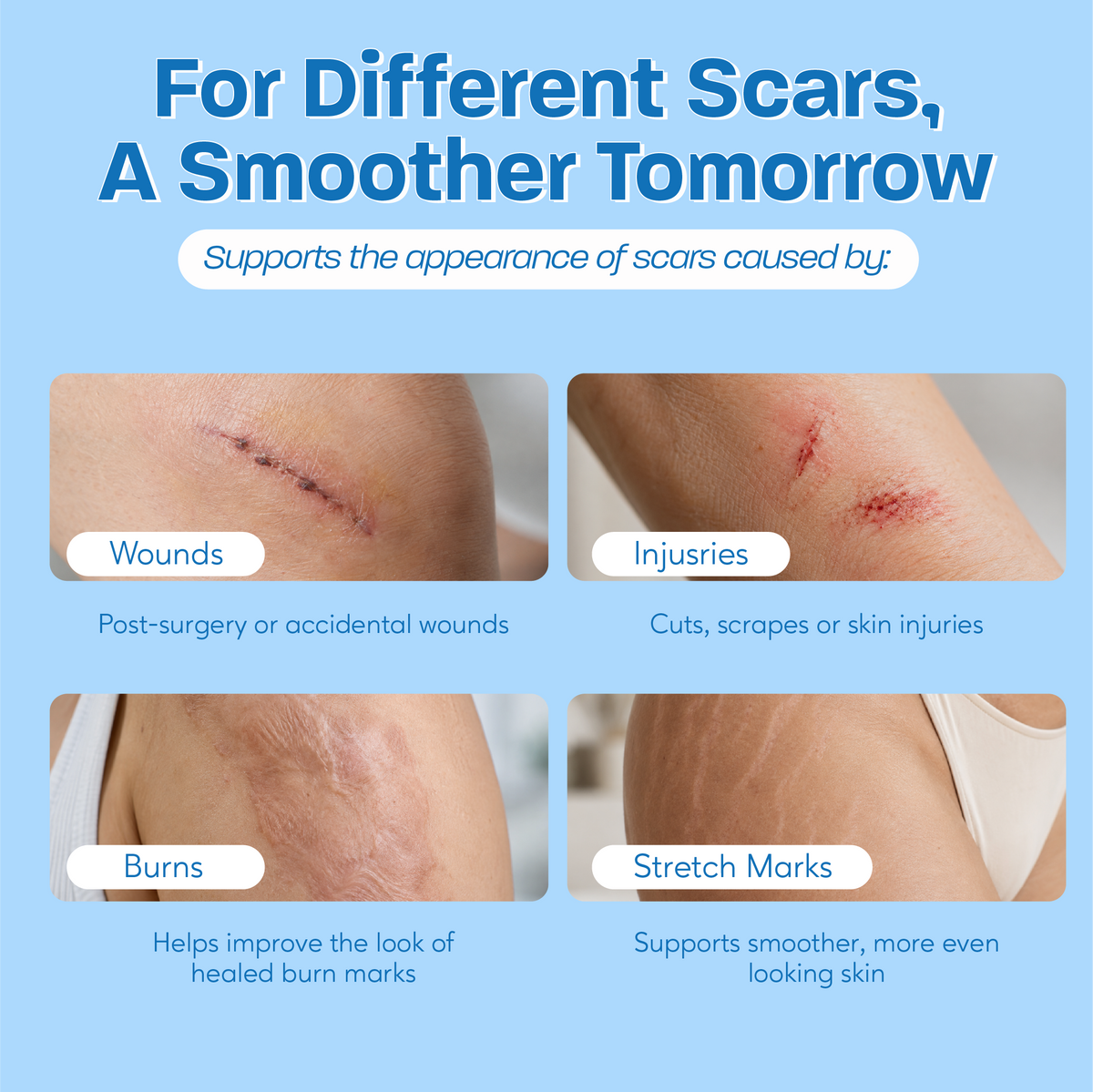 Silicone Scar Remover Gel Cream
