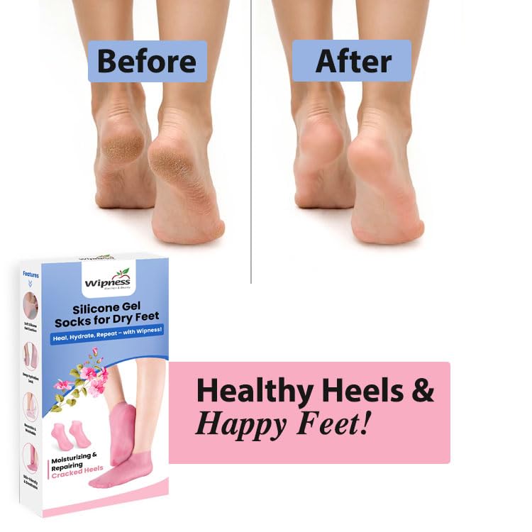 Wipness Gel Heel Reusable Socks – Cracked Heel Relief