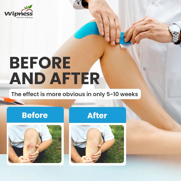 Wipness Kinesiology Tape – 5m Waterproof & Breathable Sports Tape