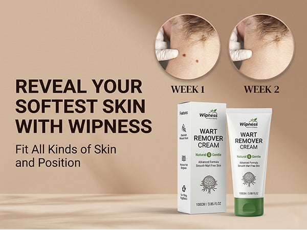 100% Natural Wart Removal Cream | Skin Tag & Massa Remover with Salicylic Acid 1.5% | For All Skin Types - Pack of 1 - 100GM