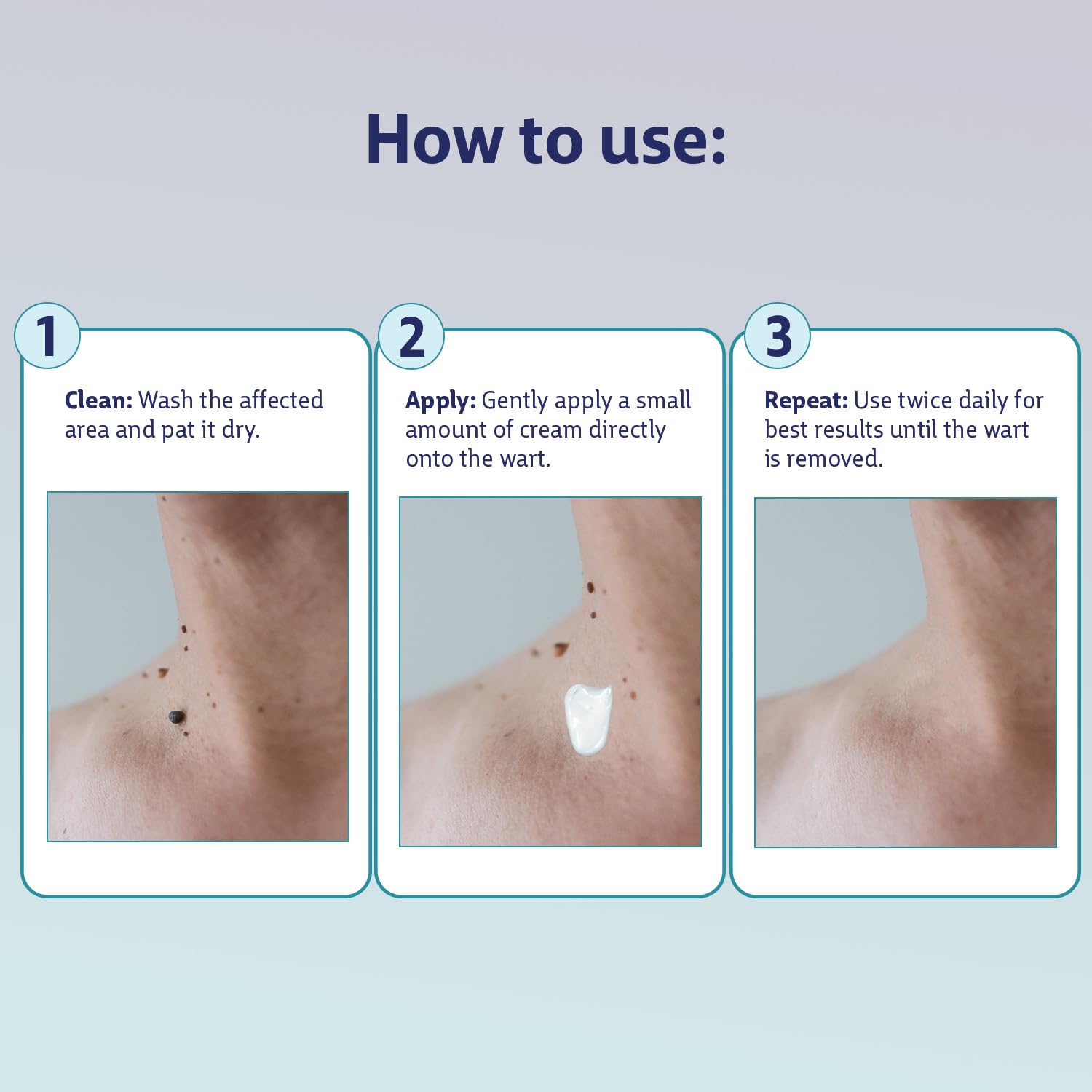 Wipness 100% Natural Wart Remover for Men & Women