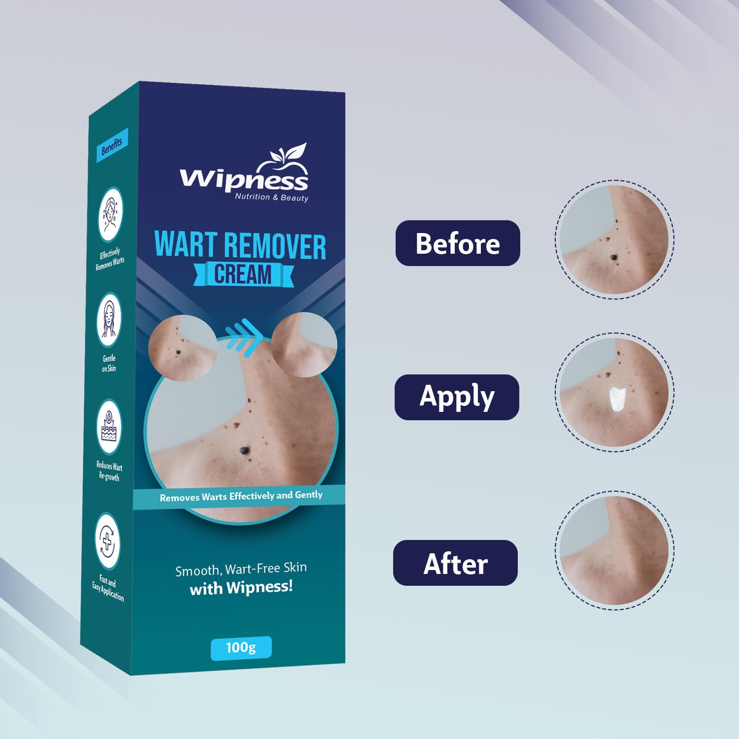 Wipness 100% Natural Wart Remover for Men & Women