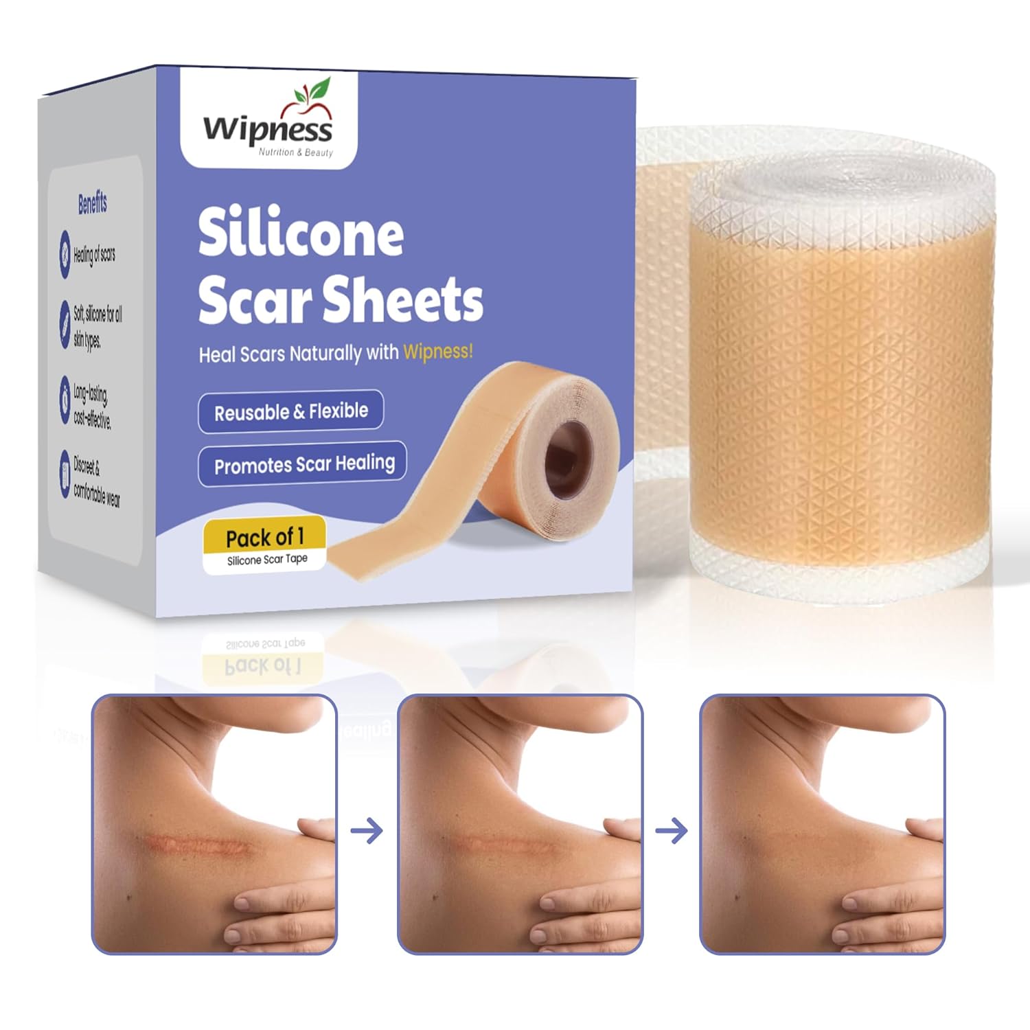 Wipness Medical Silicone Scar Sheets– Surgical & Burn Care 1.6m