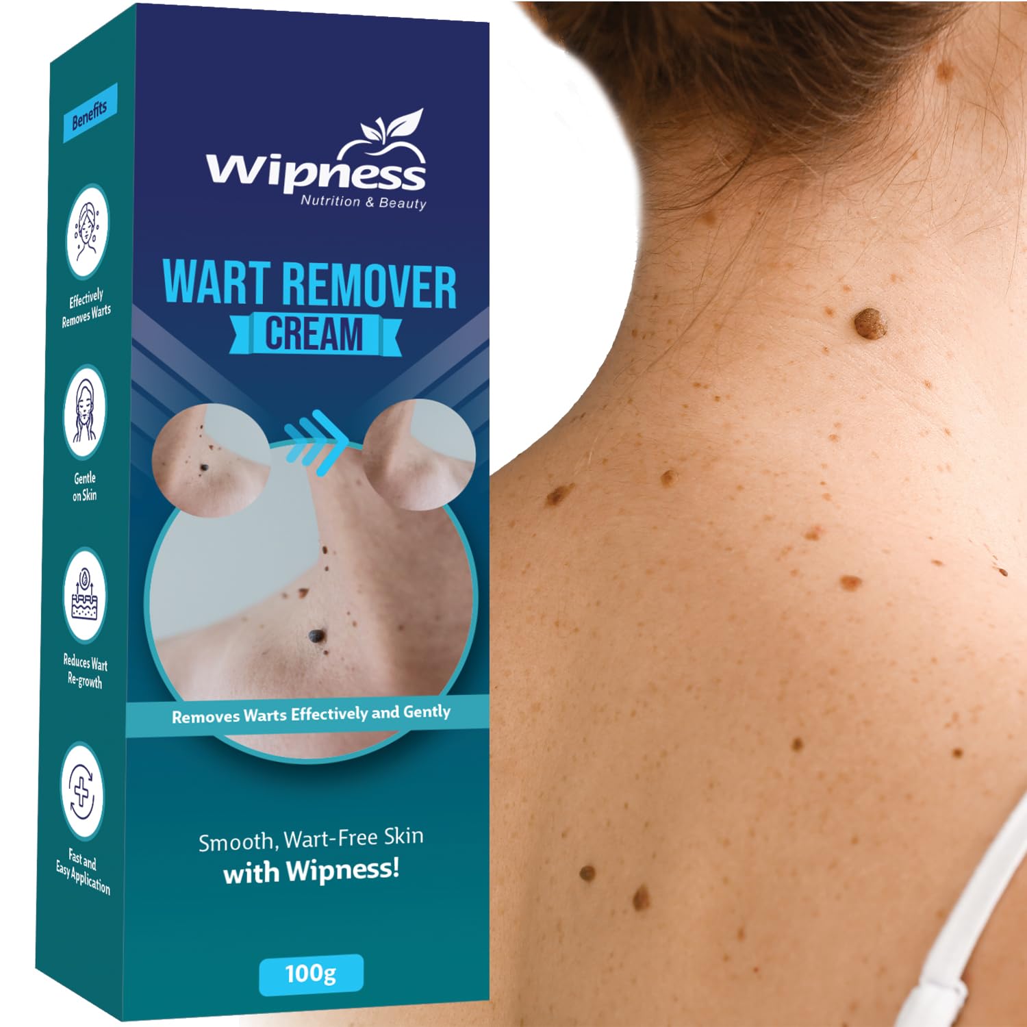 Wipness 100% Natural Wart Remover for Men & Women