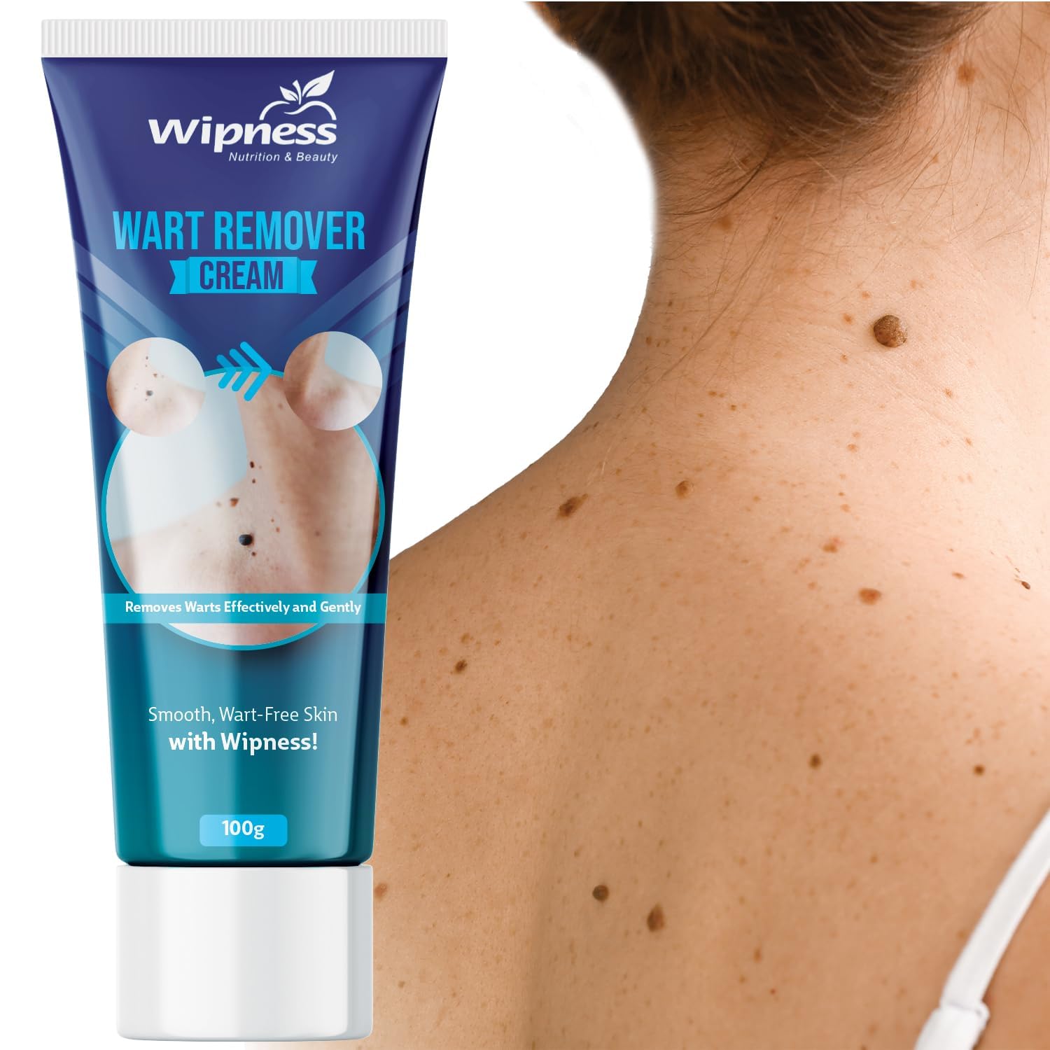 Wipness 100% Natural Wart Remover for Men & Women