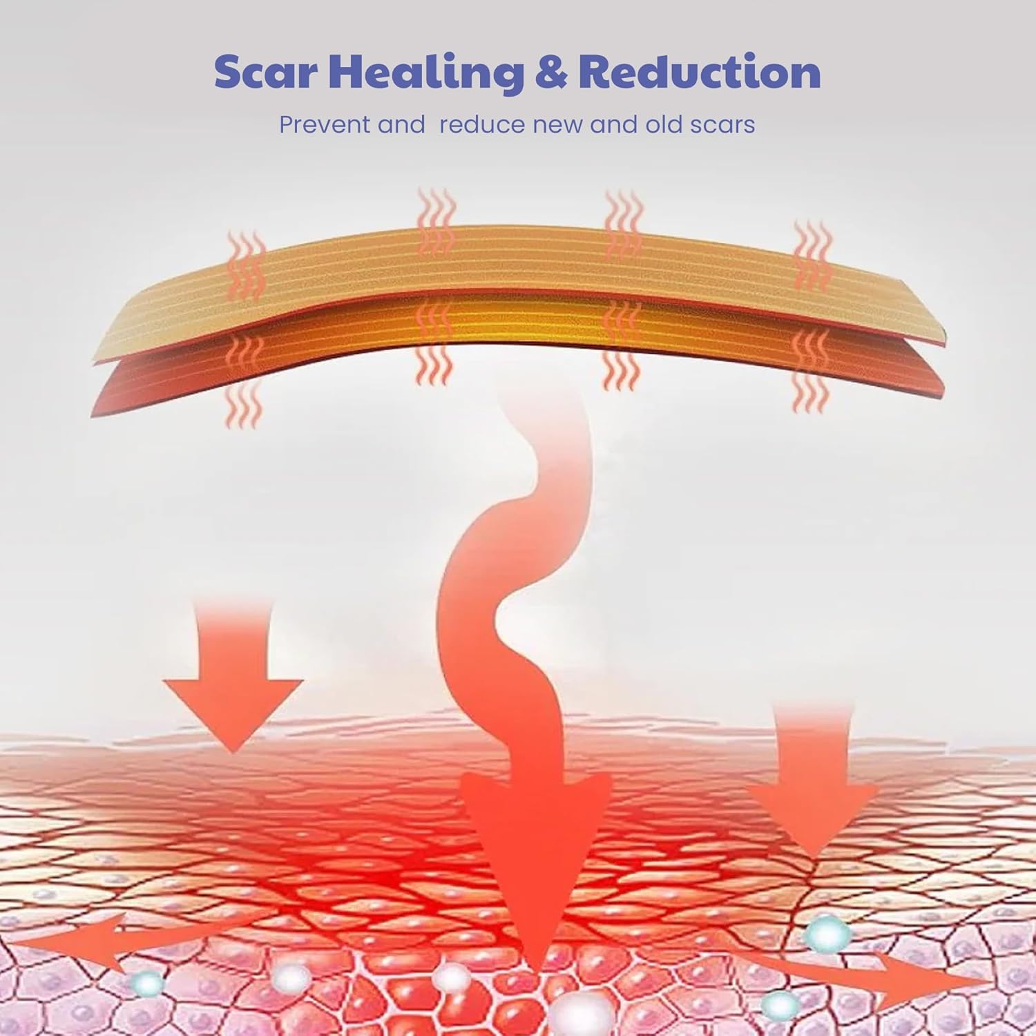 Wipness Medical Silicone Scar Sheets– Surgical & Burn Care 1.6m