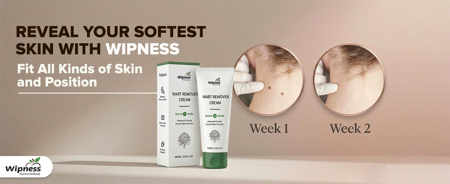 100% Natural Wart Removal Cream | Skin Tag & Massa Remover with Salicylic Acid 1.5% | For All Skin Types - Pack of 1 - 100GM