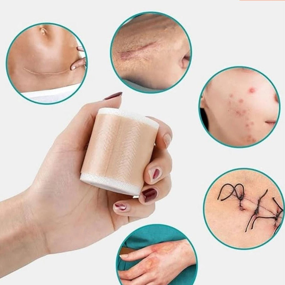 Wipness Silicone Scar Sheets – Flexible, Medical-Grade Scar Support (1.6 Meters)