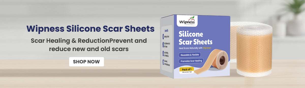 slider image slider_item_tk8kEM