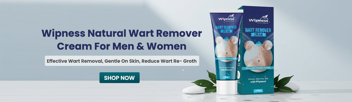 slider image slider_item_mVyjLU