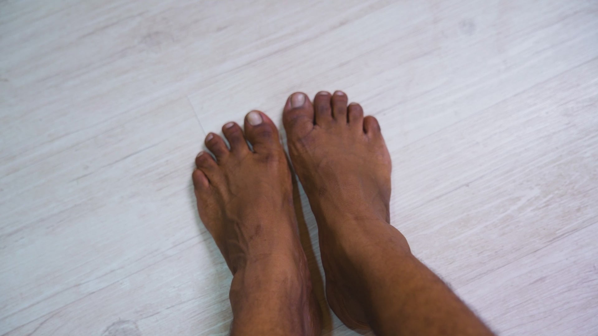 Wipness Natural Foot Peeling Mask Baby Soft Feet, Removes Dead Skin & Calluses