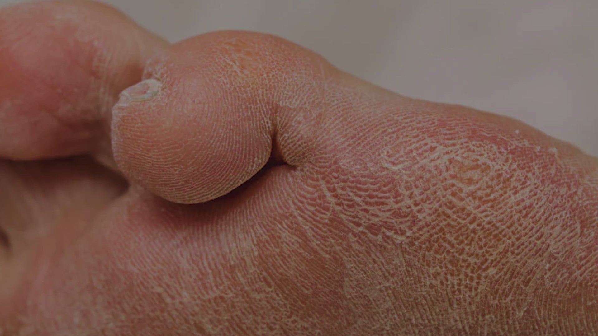 Wipness Gel Heel Reusable Socks – Cracked Heel Relief