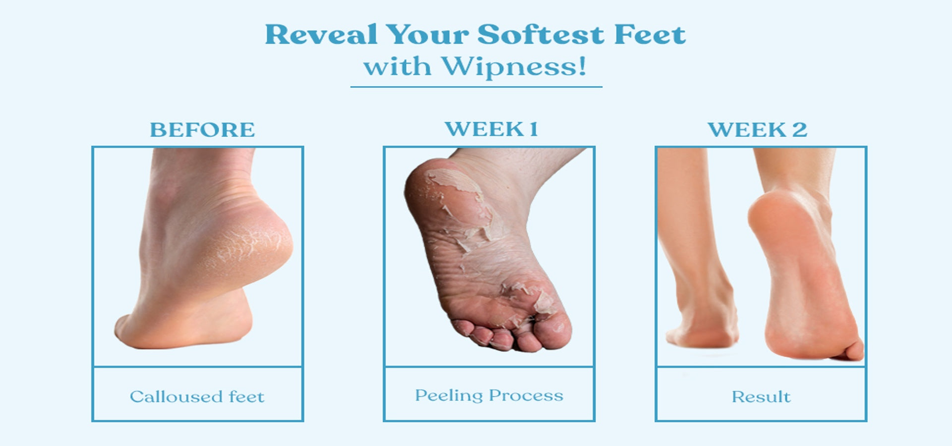 100% Natural Foot Peeling Mask Baby Soft Feet, Removes Dead Skin & Calluses